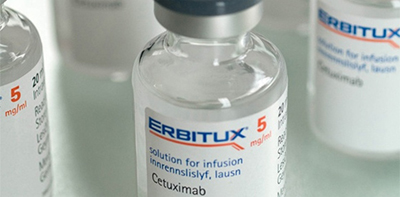 頭頸部鱗狀細胞癌靶向藥Erbitux獲英國NICE批准