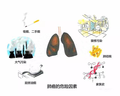 目前中国肺癌发病率的主要原因是吸烟